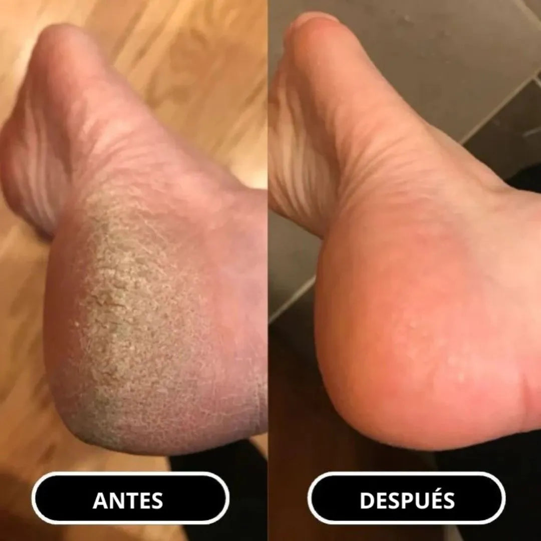 Foot balm mamá